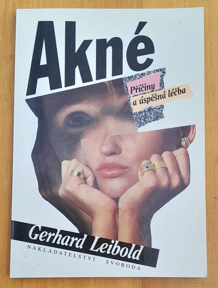 Akné / Příčiny a úspěšná léčba