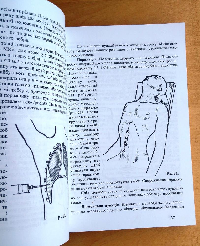 Praktični naviki z chirurgji a terapji nevidkladnich staniv