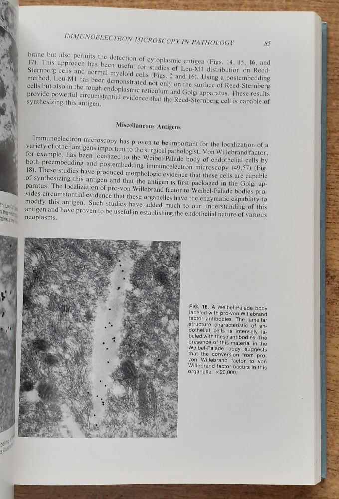 Advances in Immunohistochemistry