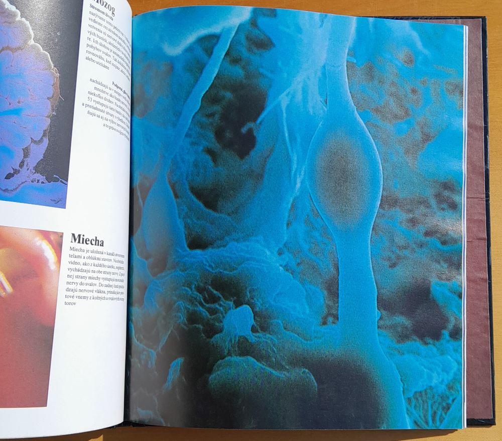 Ako sa nepoznáme / Objavná cesta s fotografickým aparátom do nášho tela