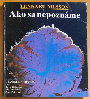 Ako sa nepoznáme / Objavná cesta s fotografickým aparátom do nášho tela
